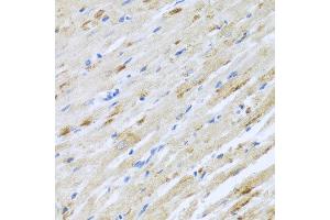 Immunohistochemistry of paraffin-embedded rat heart using STRN antibody at dilution of 1:100 (x40 lens). (Striatin Antikörper)