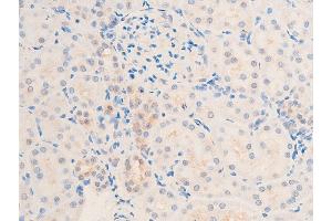 Immunohistochemistry (IHC) image for anti-Transforming Growth Factor, beta 1 (TGFB1) (C-Term) antibody (ABIN6266431)