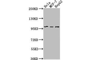 Western Blot Positive WB detected in: Hela whole cell lysate, MCF-7 whole cell lysate, HepG2 whole cell lysate All lanes: EIF4G2 antibody at 1:1000 Secondary Goat polyclonal to rabbit IgG at 1/50000 dilution Predicted band size: 103, 99 kDa Observed band size: 99 kDa (EIF4G2 Antikörper  (AA 706-907))
