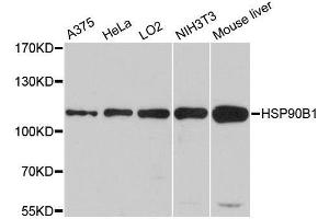 Western blot analysis of extracts of various cell lines, using HSP90B1 antibody. (GRP94 Antikörper  (AA 550-650))