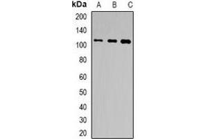 Western blot analysis of TSHR expression in Hela (A), HepG2 (B), HT29 (C) whole cell lysates. (TSH receptor Antikörper)