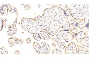 Detection of DSG3 in Human Placenta Tissue using Polyclonal Antibody to Desmoglein 3 (DSG3) (Desmoglein 3 Antikörper  (AA 858-999))