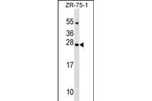NXNL1 Antibody (Center) (ABIN1538700 and ABIN2849312) western blot analysis in ZR-75-1 cell line lysates (35 μg/lane). (NXNL1 Antikörper  (AA 94-121))
