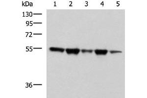 Western blot analysis of A172 Hela HepG2 K562 and PC3 cell lysates using FKBP5 Polyclonal Antibody at dilution of 1:600 (FKBP5 Antikörper)