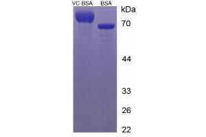 Image no. 2 for Ascorbic Acid (Vitamin C) protein (BSA) (ABIN1880281) (Vitamin C Protein (BSA))