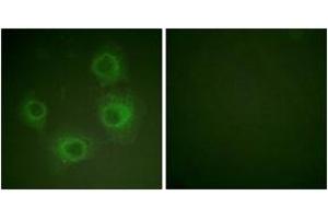 Immunofluorescence analysis of HuvEc cells, using NMDAR2A/B (Phospho-Tyr1246/1252) Antibody. (NMDAR2A + 2B Antikörper  (pTyr1246))