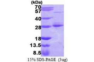 SDS-PAGE (SDS) image for RAB17, Member RAS Oncogene Family (RAB17) (AA 1-212) protein (His tag) (ABIN667487)
