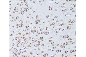 Immunohistochemistry of paraffin-embedded Mouse brain using TNFRSF11A Polyclonal Antibody at dilution of 1:100 (20x lens). (TNFRSF11A Antikörper)
