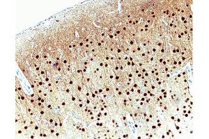 Pyrimidal cells in rat cortex, formalin-fixed paraffin embedded tissue, no pre-treatment, 20X (CAMK4 Antikörper  (AA 1-241))