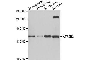 Western blot analysis of extracts of various cell lines, using ATP2B2 antibody. (ATP2B2 Antikörper)