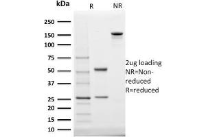SDS-PAGE Analysis Purified StAR Mouse Monoclonal Antibody (STAR/2140). (STAR Antikörper  (AA 39-108))