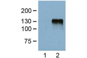 1:1000 (1 ug/ml) antibody dilution probed against HEK 293 cells transfected with DYKDDDDK-tagged protein vector; unstranfected (1) and transfected (2). (DYKDDDDK Tag Antikörper)