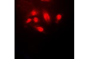 Immunofluorescent analysis of Cofilin staining in HeLa cells.