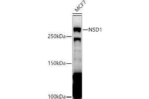 anti-Nuclear Receptor Binding SET Domain Protein 1 (NSD1) antibody
