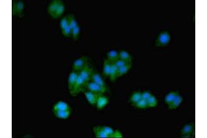 Immunofluorescent analysis of HepG2 cells using ABIN7172487 at dilution of 1:100 and Alexa Fluor 488-congugated AffiniPure Goat Anti-Rabbit IgG(H+L) (BTF3 Antikörper  (AA 48-206))