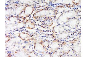 Paraformaldehyde-fixed, paraffin embedded rat kidney tissue, Antigen retrieval by boiling in sodium citrate buffer(pH6) for 15min, Block endogenous peroxidase by 3% hydrogen peroxide for 30 minutes, Blocking buffer (normal goat serum) at 37°C for 20min, Antibody incubation with Rabbit Anti-IGF1R (Tyr1165 + Tyr1166) Polyclonal Antibody, Unconjugated  at 1:500 overnight at 4°C, followed by a conjugated secondary and DAB staining (IGF1R Antikörper  (pTyr1165, pTyr1166))