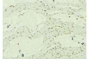 ABIN6277244 at 1/100 staining Mouse muscle tissue by IHC-P. (SNCG Antikörper  (C-Term))