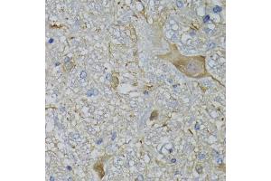 Immunohistochemistry of paraffin-embedded mouse brain using CALML5 antibody (ABIN5974468) at dilution of 1/100 (40x lens). (CALML5 Antikörper)