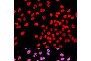 Immunofluorescence analysis of U2OS cells using IKZF1 Polyclonal Antibody (IKZF1 Antikörper)