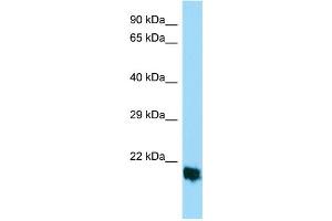 Host: Rabbit Target Name: MPLKIP Sample Type: HepG2 Whole Cell lysates Antibody Dilution: 1. (TTDN1 Antikörper  (Middle Region))