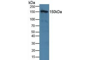 Detection of TJP2 in Human Hela Cells using Polyclonal Antibody to Tight Junction Protein 2 (TJP2) (TJP2 Antikörper  (AA 307-669))