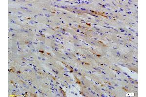 Immunohistochemistry (IHC) image for anti-BTG Family, Member 2 (BTG2) (AA 31-110) antibody (ABIN723905)