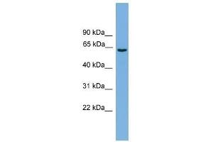 Western Blot showing SLCO1A2 antibody used at a concentration of 1-2 ug/ml to detect its target protein. (SLCO1A2 Antikörper  (Middle Region))