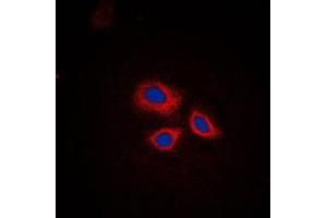 Immunofluorescent analysis of RNF144A staining in HepG2 cells. (RNF144A Antikörper  (Center))
