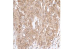 Immunohistochemistry (IHC) image for anti-Mitogen-Activated Protein Kinase-Activated Protein Kinase 5 (MAPKAPK5) (AA 423-473) antibody (ABIN7453731)