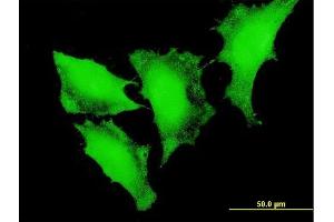 Immunofluorescence of monoclonal antibody to FOXO3 on HeLa cell. (FOXO3 Antikörper  (AA 361-460))