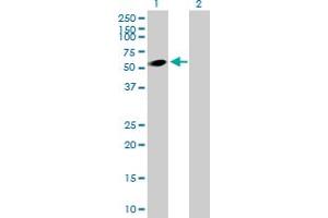Western Blot analysis of DEPDC7 expression in transfected 293T cell line by DEPDC7 MaxPab polyclonal antibody. (DEPDC7 Antikörper  (AA 1-511))