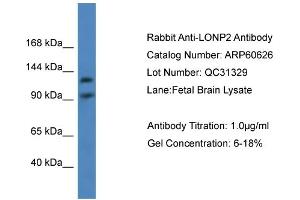 WB Suggested Anti-LONP2  Antibody Titration: 0. (LONP2 Antikörper  (C-Term))