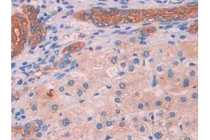 Immunohistochemistry (IHC) image for anti-Uncoupling Protein 2 (Mitochondrial, Proton Carrier) (UCP2) (AA 154-289) antibody (ABIN1175758)