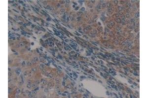 Immunohistochemistry (IHC) image for anti-Heat Shock 60kDa Protein 1 (Chaperonin) (HSPD1) (AA 316-573) antibody (ABIN7440455)