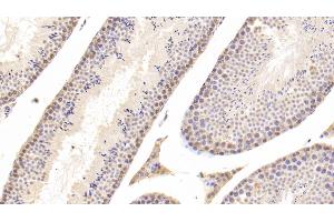 Detection of CTSD in Mouse Testis Tissue using Polyclonal Antibody to Cathepsin D (CTSD) (Cathepsin D Antikörper  (AA 66-410))