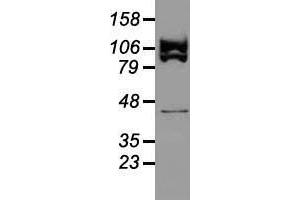 Western blot analysis of 35 µg of cell extracts from human (HeLa) cells using anti-USP38 antibody. (USP38 Antikörper)