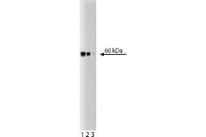 Western Blotting (WB) image for anti-Heat Shock 60kDa Protein 1 (Chaperonin) (HSPD1) antibody (ABIN968591)