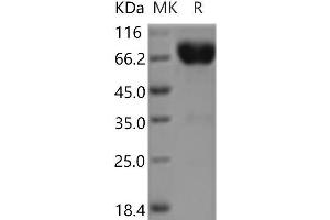 IL10RB Protein (Fc Tag)