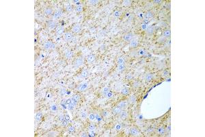 Immunohistochemistry of paraffin-embedded rat brain using INHA antibody. (Inhibin alpha Antikörper)