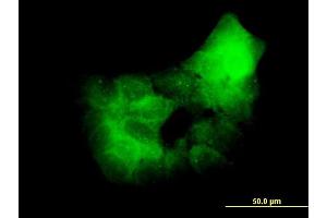 Immunofluorescence of monoclonal antibody to PRKCD on A-431 cell. (PKC delta Antikörper  (AA 577-676))