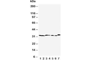 Western blot testing of Caspase-6 antibody  and Lane 1:  rat liver;  2: rat kidney;  3: rat testis;  4: NRK;  5: mouse liver;  6: mouse kidney;  7: mouse testis tissue lysate (Caspase 6 Antikörper  (AA 7-27))