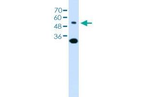 Western blot analysis of Jurkat cell lysate with SLC2A5 polyclonal antibody . (SLC2A5 Antikörper  (AA 300-349))
