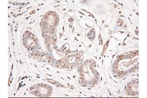 Immunohistochemical staining of paraffin-embedded breast using anti-NTF3 (ABIN2452548) mouse monoclonal antibody. (Neurotrophin 3 Antikörper  (AA 139-257))