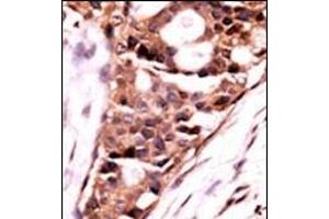 Immunohistochemistry (Paraffin-embedded Sections) (IHC (p)) image for anti-Protein Phosphatase 3, Catalytic Subunit, beta Isozyme (PPP3CB) (AA 1-30), (N-Term) antibody (ABIN392893)