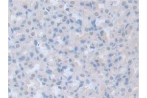 Immunohistochemistry (IHC) image for anti-Intersectin 1 (ITSN1) (AA 1-227) antibody (ABIN7444238)