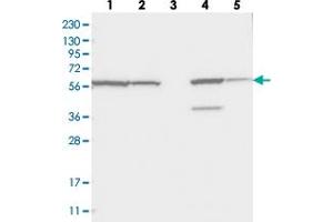 Western blot analysis of Lane 1: RT-4, Lane 2: U-251 MG, Lane 3: Human Plasma, Lane 4: Liver, Lane 5: Tonsil with ZNF354C polyclonal antibody  at 1:250-1:500 dilution. (ZNF354C Antikörper)