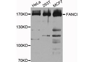 Western blot analysis of extracts of various cell lines, using FANCI antibody. (FANCI Antikörper)