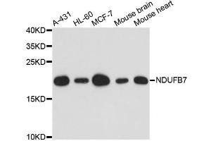 Western blot analysis of extracts of various cell lines, using NDUFB7 antibody. (NDUFB7 Antikörper)