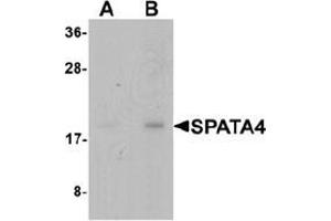 Western blot analysis of SPATA4 in mouse stomach tissue lysate with SPATA4 Antibody  at (A) 1 and (B) 2 μg/mL (SPATA4 Antikörper  (C-Term))