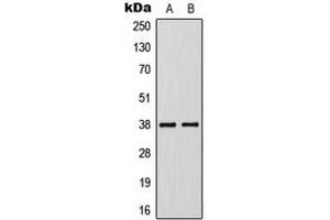 Western blot analysis of KLF1/5/7 expression in Jurkat (A), VEC (B) whole cell lysates. (KLF1/5/7 Antikörper  (C-Term))